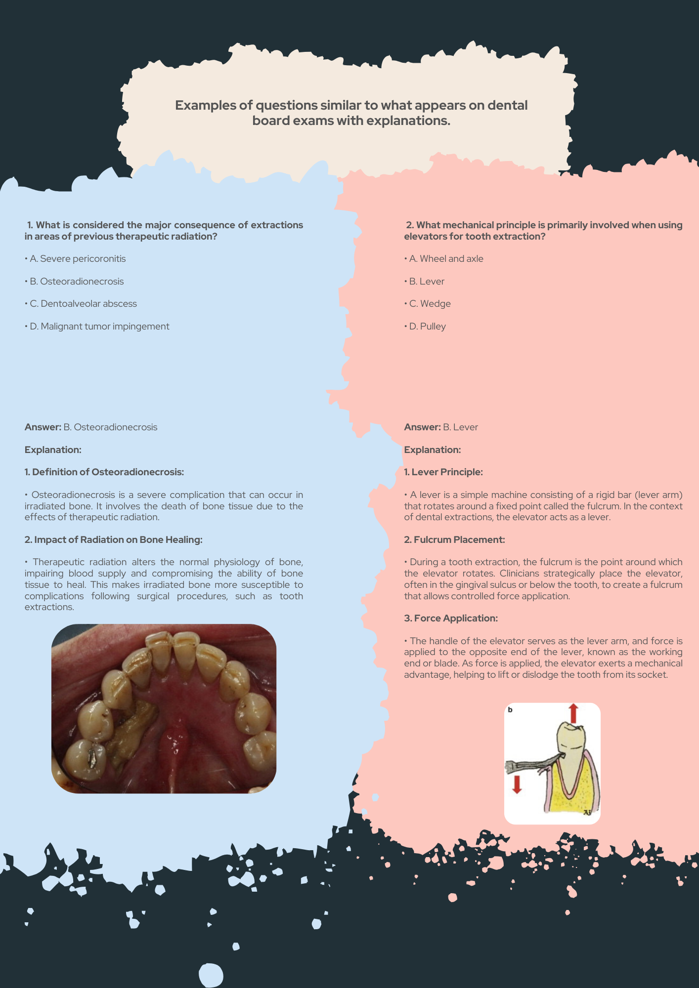 Oral Surgery Guide PDF