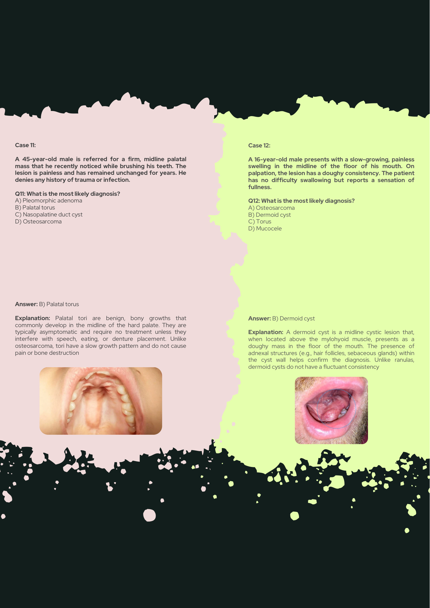 Oral Pathology Full Guide With 150 Clinical Case Questions Explained