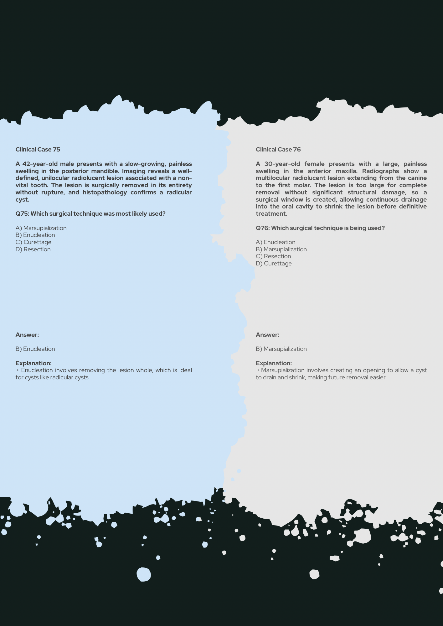 Oral Surgery Guide PDF With Oral Surgery Clinical Challenges with Explanations