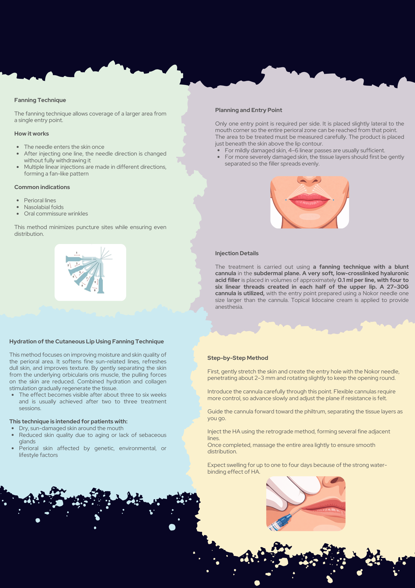 Aesthetic Lip Injections Complete Guidebook PDF