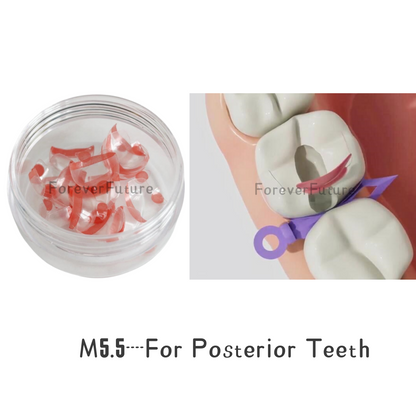 Bioclear Anterior/Posterior Transparent Matrix