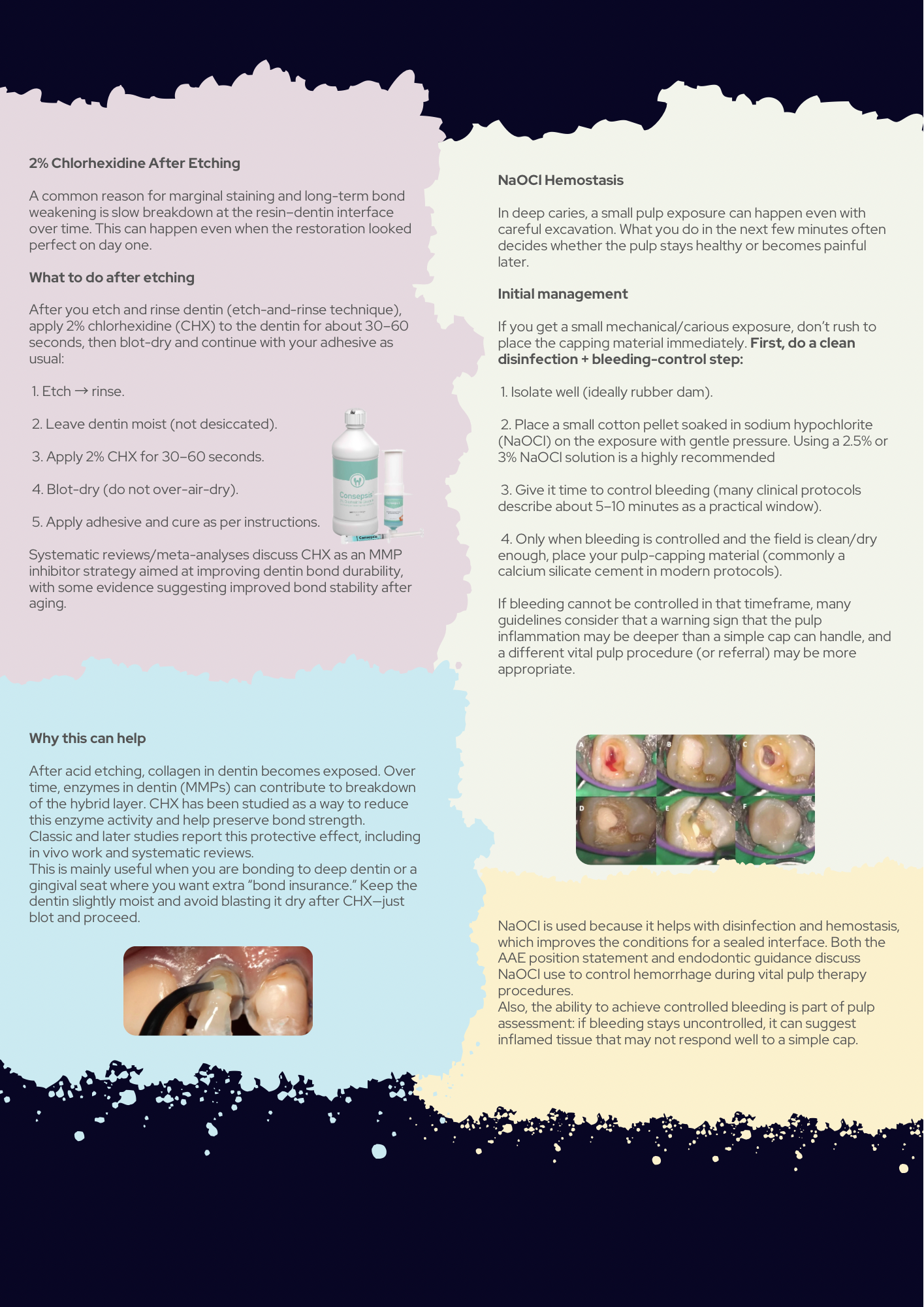 Tips & Tricks in Operative Dentistry