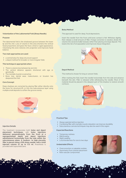 Aesthetic Lip Injections Complete Guidebook PDF