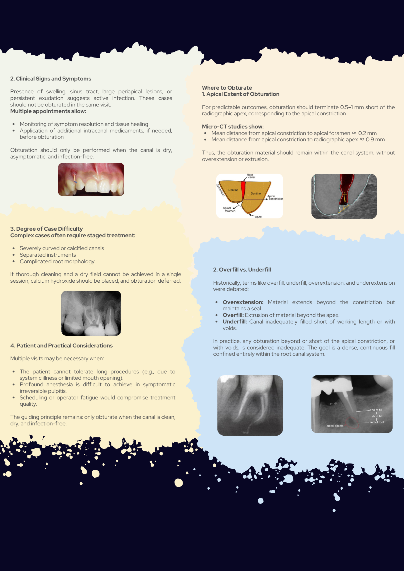 Prevention and Management of Endodontic Errors