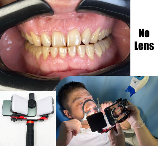 Dental Photography LED Mobile Twin Light