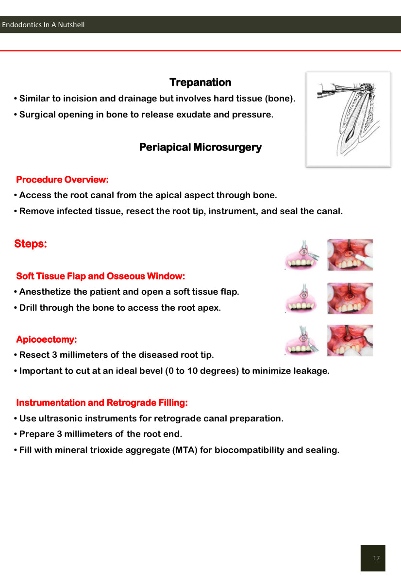 Endodontics In A Nutshell