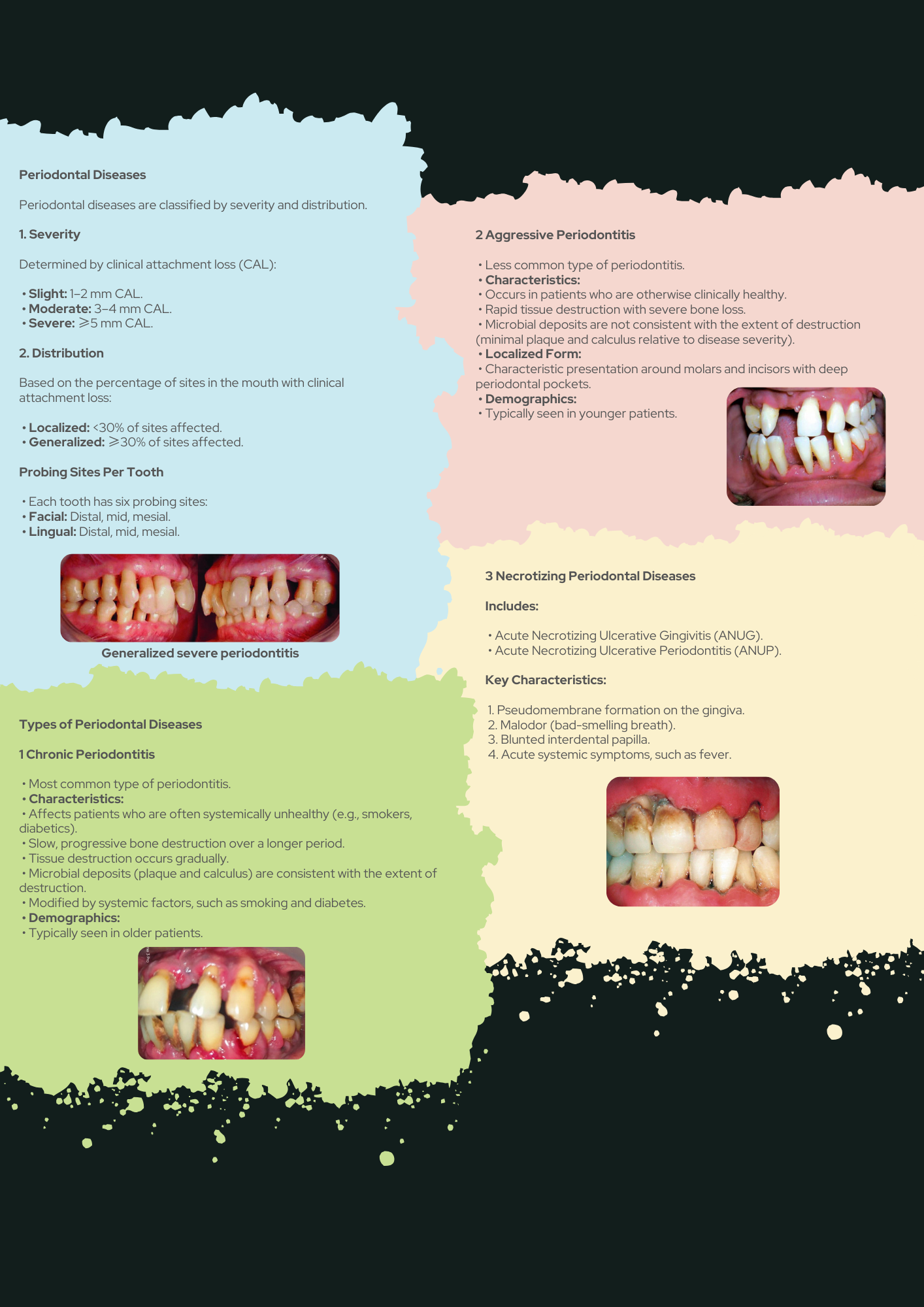 Periodontics Full Guide PDF