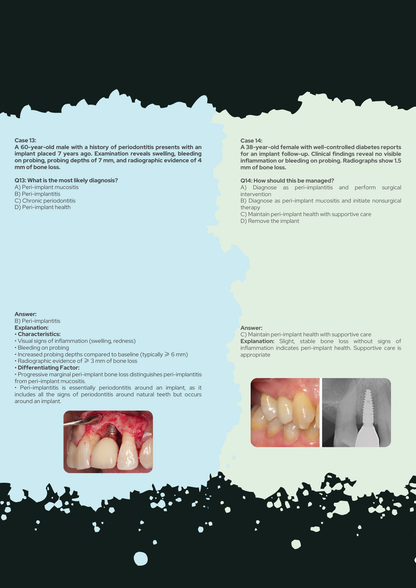 56 Periodontics Clinical Scenarios with 
Explanations