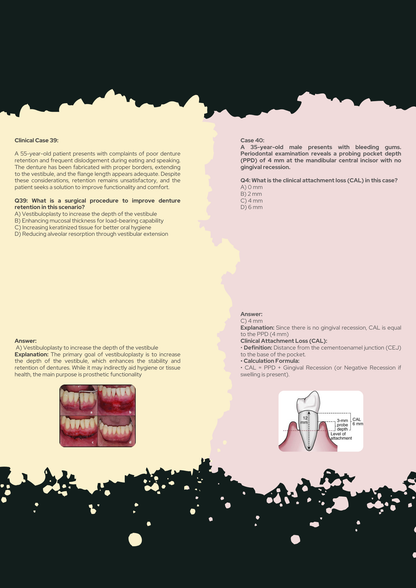 56 Periodontics Clinical Scenarios with 
Explanations
