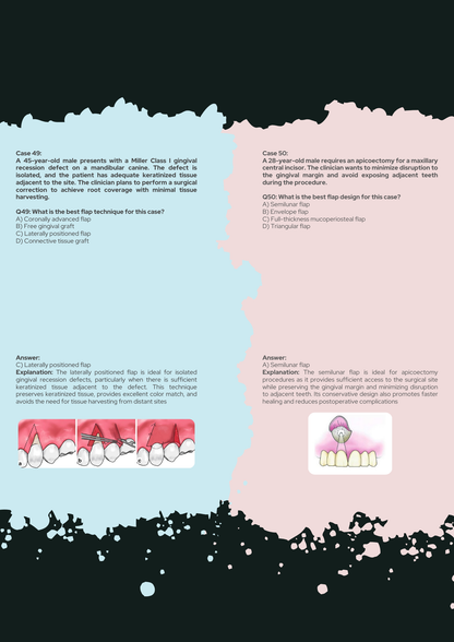 56 Periodontics Clinical Scenarios with 
Explanations