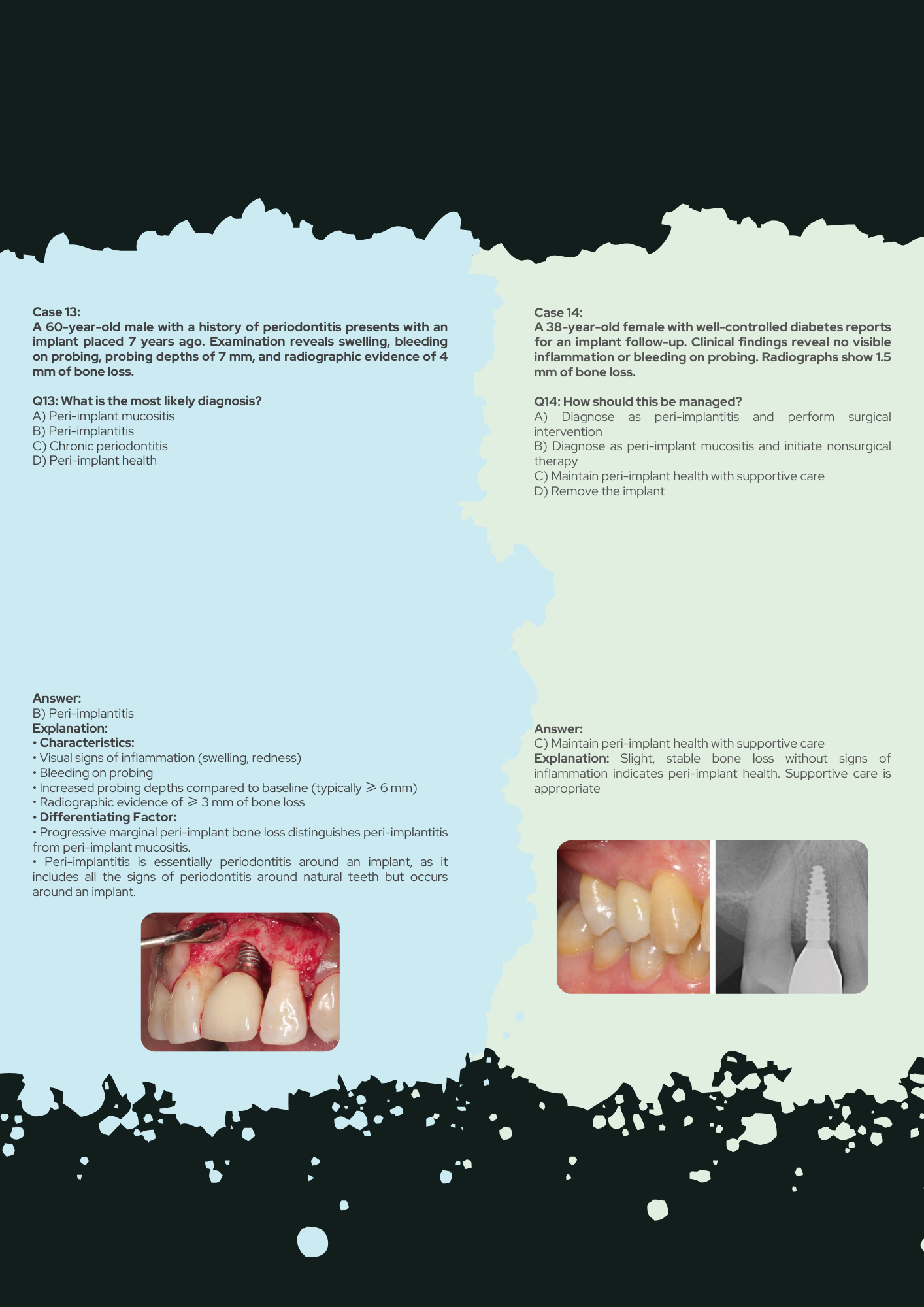 Periodontics Full Guide PDF With Clinical Case Questions Explained