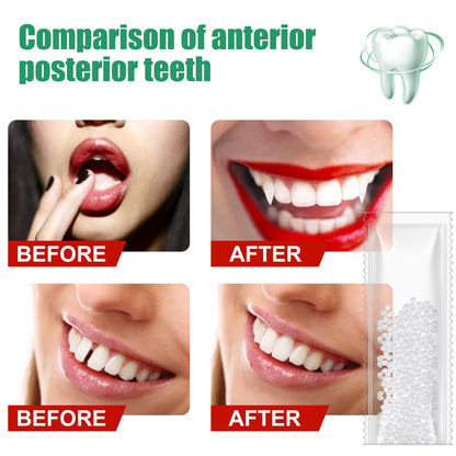 Resin Tooth Repair Glue Shapeable Teeth Gaps Filling