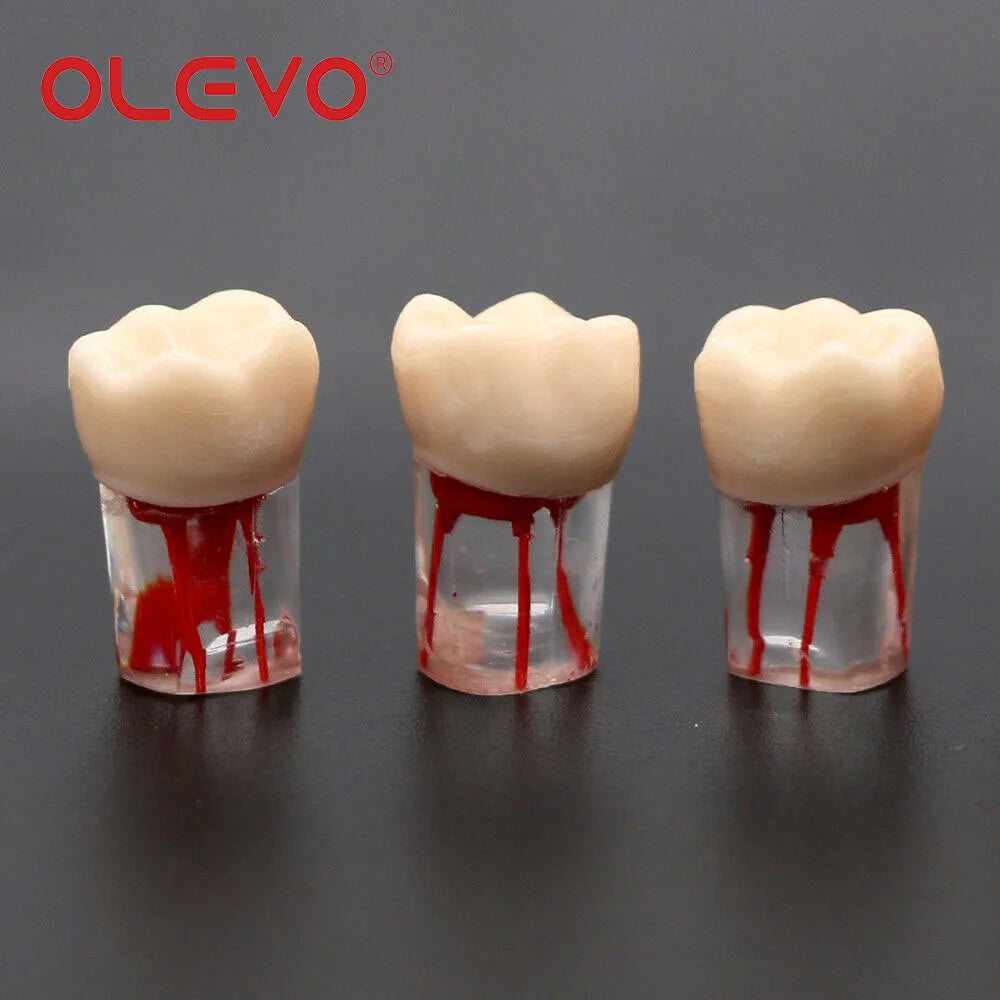 Dental RCT Endo Teeth Model 10 Pcs