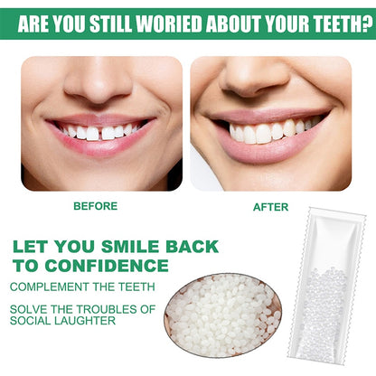 Resin Tooth Repair Glue Shapeable Teeth Gaps Filling