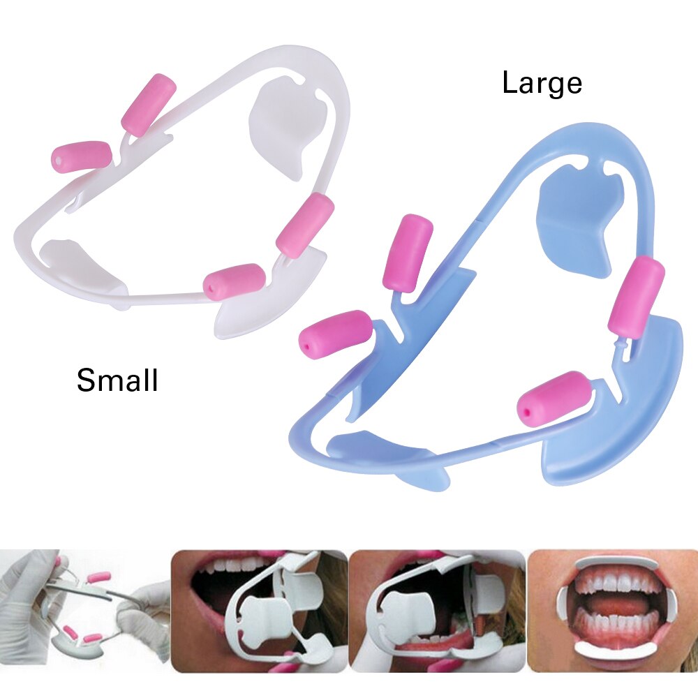 Dental 3D Cheek Retractor O Shape autoclavable